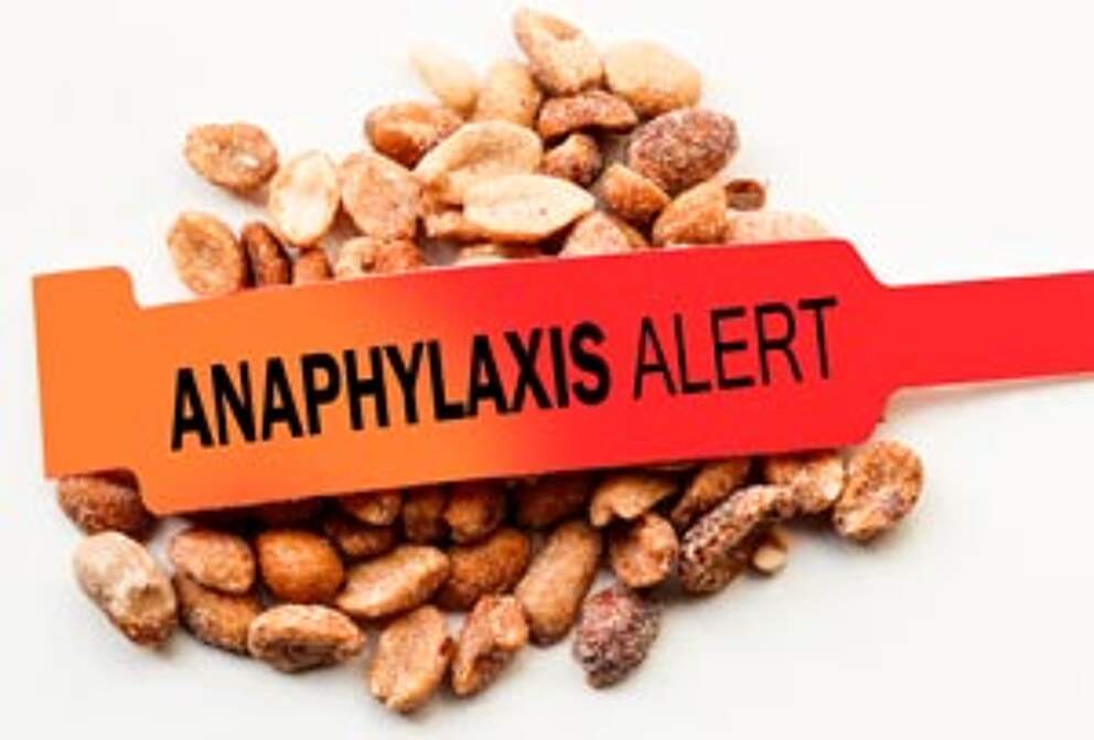 Peanuts on a Ketogenic Diet Eat or Avoid? KetoDiet Blog