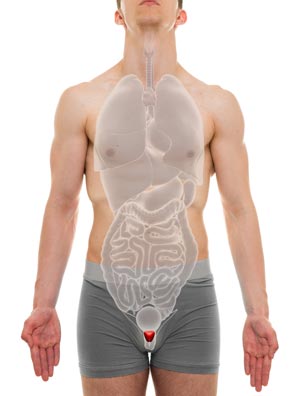 Hyperinsulinemia and Men's Health: Is There a Male Equivalent to PCOS?